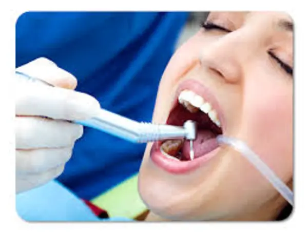 FASE HIGIENICA DENTAL (DETARTRAJE Y PROFILAXIS)